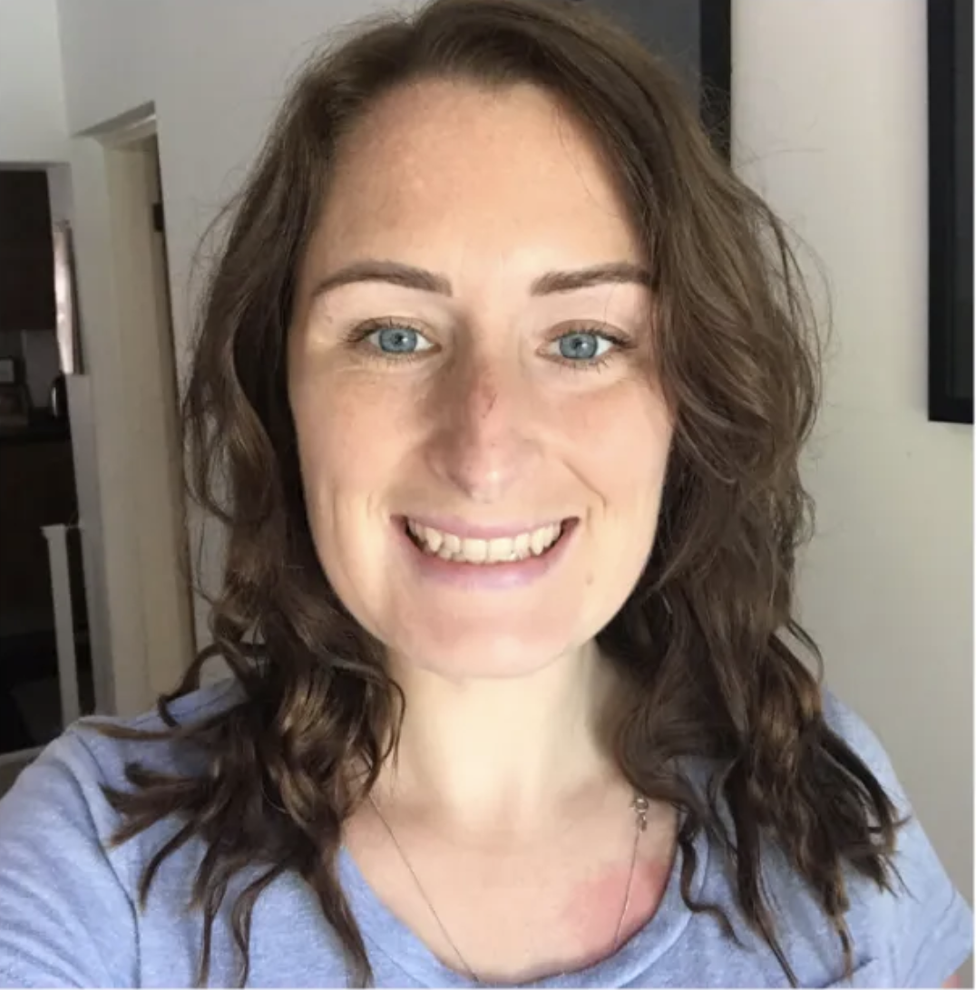 Vestibular Migraines